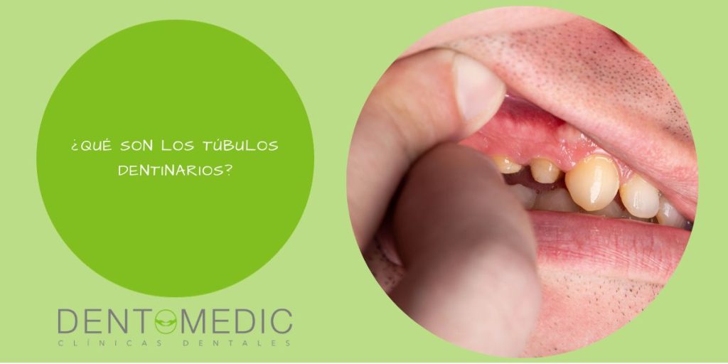 ¿Qué son los túbulos dentinarios?