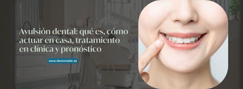 avulsión dental