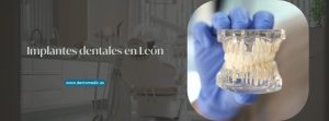 implantes dentales en León