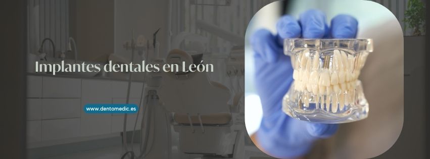 implantes dentales en León