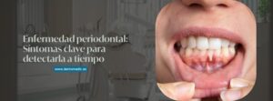 Enfermedad periodontal: Síntomas clave para detectarla a tiempo