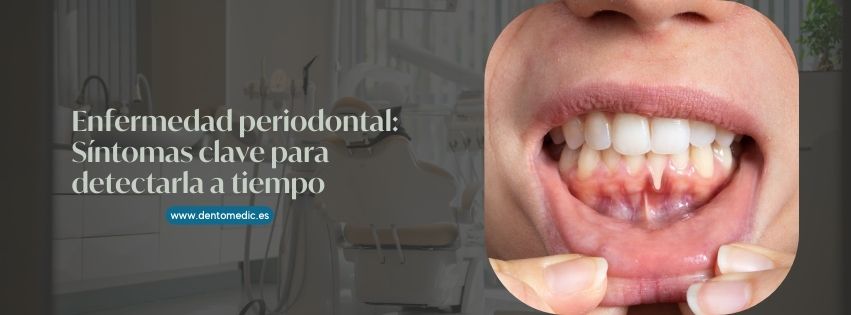 enfermedad periodontal