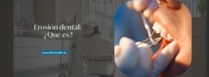 erosión dental