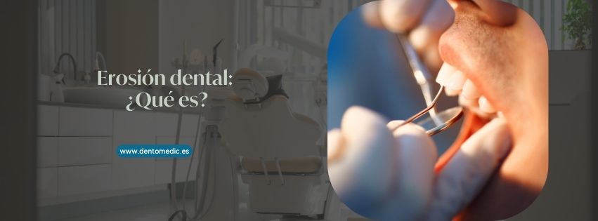 erosión dental