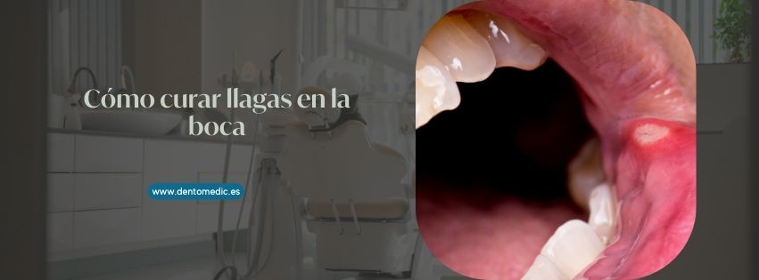 llagas en la boca
