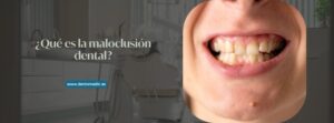 maloclusión dental