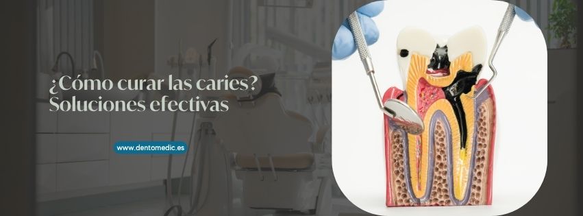 como curar las caries
