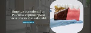 limpieza periodontal
