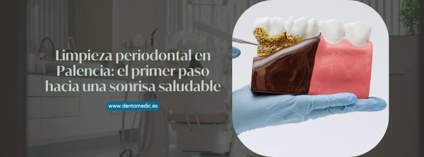 limpieza periodontal