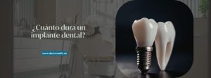 cuánto dura un implante dental