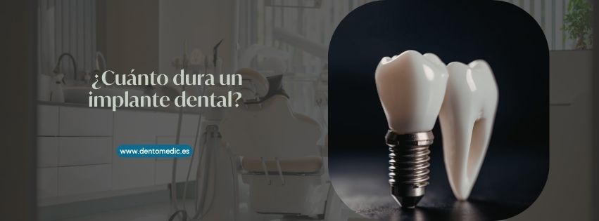 cuánto dura un implante dental